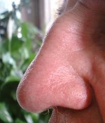 Nose